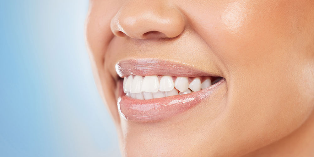 Fluoride Treatment Winchester