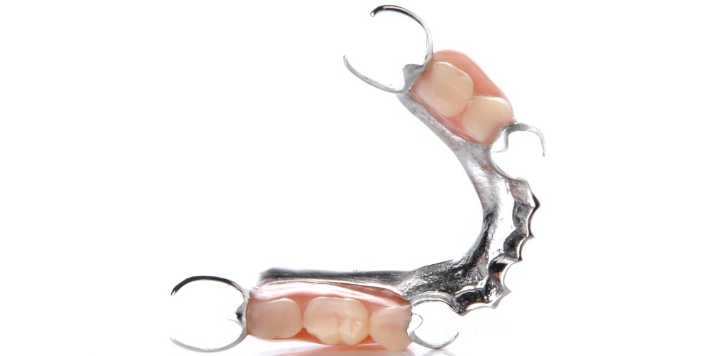 Partial Dentures Winchester