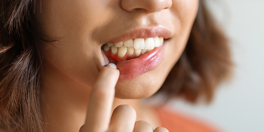 Periodontal Therapy Winchester