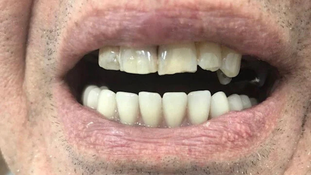 Gallery After Image 1