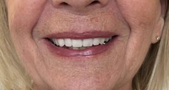 Gallery After Image 2