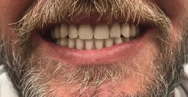 Gallery After Image 3