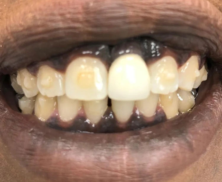 Gallery After Image 4