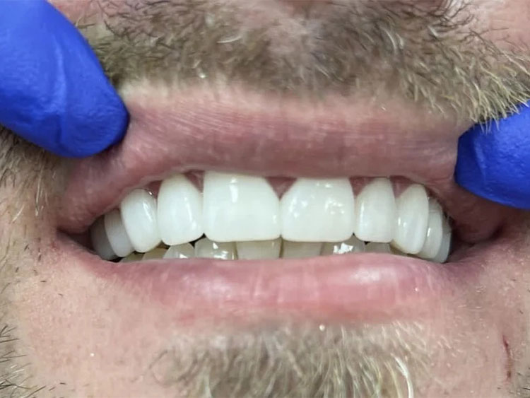 Gallery After Image 5