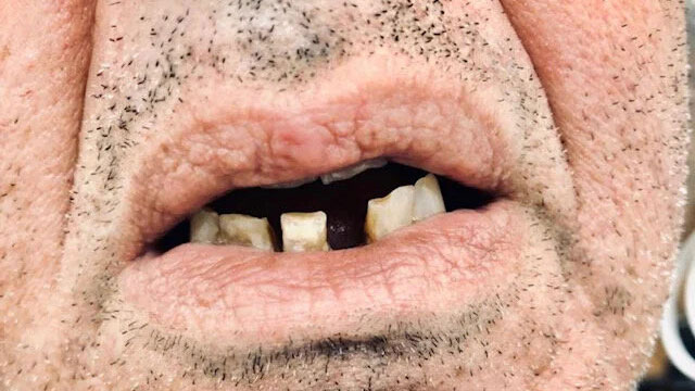 Gallery Before Image 1