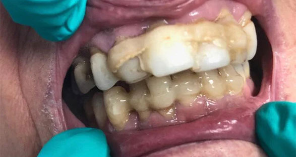 Gallery Before Image 2