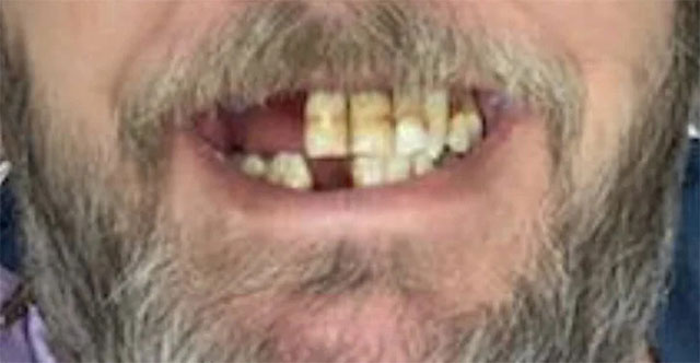 Gallery Before Image 3