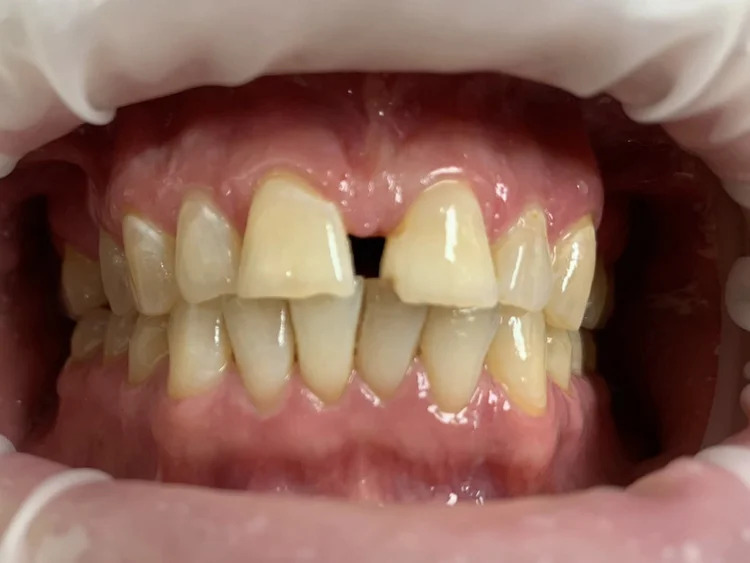 Gallery Before Image 5